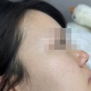 림스플래닝