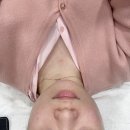 뉴스타 | 신논현 뉴스타의원에서 온다리프팅 받은 후기 내돈내산 + 10일차 후기 공유