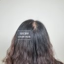 스칼프디자인센터 광주점 이미지