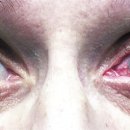 연세바른안과의원 이미지