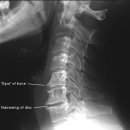 피부, fascia, 근육, 건, 인대, 관절, 연골, 뼈, 신경 등의 각각 재생하는 방법 탐구 이미지