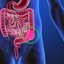 파동반점 | 80대 노인 변비 원인과 해결법: 3일간 화장실 못 가신 친정아버지의 식습관 리얼 후기
