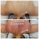 부산 당감동 바디관리 미샤인 뷰티 l 거북목, 일자목 교정, 승모근까지 개선!