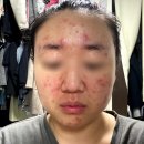 트루코치 | 안 먹을 수 없다면 관리해야하니까, 트루그린 섭취 솔직후기