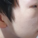 핸즈다움 | 천연어성초비누 여드름에좋은비누 핸즈다움 사용후기