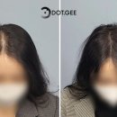 정수리 이미지