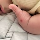 조윤향피부과의원 티스토리