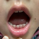수목원치과의원 네이버블로그