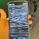 현대한의원 | 다이어트한의원 한약 피부관리 방문 후기 형인재한의원