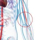 ■11월05일 월요일■말초동맥질환 가볍게 봤단 '큰 코'.. 심뇌혈관 위험 신호일 수도 이미지