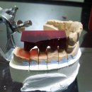 화인덴탈 이미지