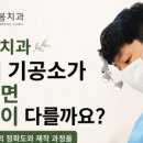 봄치과기공소 네이버블로그