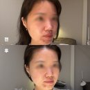 군산 여드름 피부관리 3인동시가능 수송동 루아에스테틱
