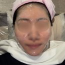 연세애드미피부과의원 네이버블로그