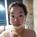 이중턱제거팩) 더유핏 브이케어 4D팩으로 편하게 관리하자