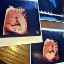 노블산부인과의원 이미지