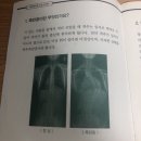 아산시-2021-003 | 척추측만증 수술 후기 1