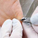 W365메디컬의원 | 부산 남구 발각질 제거 전문 클리닉 푸스케어 부산 광안리 W스퀘어점