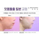 초읍치과의원 네이버블로그