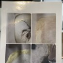 연제구-123 | 부산 연제구 한국식 두피관리 두피똥 스파