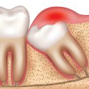 수지좋은치과의원 이미지
