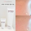 심해진 | 기미집중타겟 <코페르 큐리페어 멜라크림> 출산으로 심해진 기미 고민 해결 한 후기