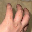 경산희망센터 | 강동 고은빛여성병원 이새미 원장님 제왕절개 후기 (부제: 제왕절개 희망편)
