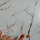 수지침&쑥뜸 이미지