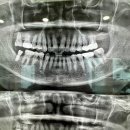 백세튼튼치과의원 이미지