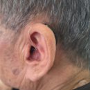 세종보청기 | 세종보청기 오티콘보청기 세종센터 방문후기