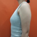 '2-30 | 지방형 팔뚝 무한람스 22보틀, 뒷볼록 2보틀 30일차 후기｜한달차 변화·후관리 비용
