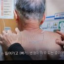 암 환자 최종,척수강 내 약물 주입술 이미지