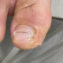 다시온 리케어 이미지