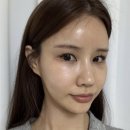 부산센텀 피부한의원 &#39;PN리빌더 R&#39;로 속건조해결 한 후기(리쥬란 비교)