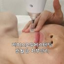 중구반월당피부관리 제이스오유에스테틱 물방울 엑소좀스킨부스터 후기 _ 주차 정보