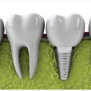 연세가은치과의원 이미지