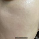 입다!비타민C | 라비오라 레몬 허니 워시오프팩 내돈내산 솔직후기와 효과적인 사용법 정리