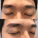 모차르트성형외과의원 | [모차르트성형외과] 용산 반영구 잘하는 곳 / 용산 남자눈썹문신 잘하는 곳