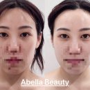 아벨라 짐 | 아벨라뷰티 윤곽부터 데콜테까지 완벽한 대전신부관리 후기
