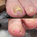 수원 광교 내성발톱 남자들도 관리하는 시대! 맨즈토탈뷰티샵 추천