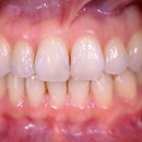 에세레스 이미지