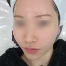 다은채 | 서울대입구 리프팅 에스테틱 전문 : 에스테틱다은 업핏 후기