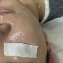 샵370 | 천안 두정동 피부관리샵 오마주21 방문 후기 | 모공, 피지 집중케어