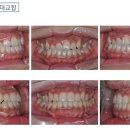 미르치과병원.(치아교정.임플란트 전문병원) 이미지