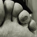 사천산소가스 이미지