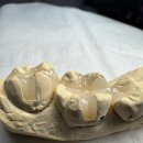 설 치과기공소 이미지