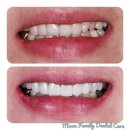 장백치과기공소 이미지