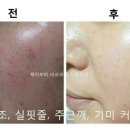 부띠