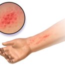 바를정한의원 이미지