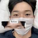 글로우브로우